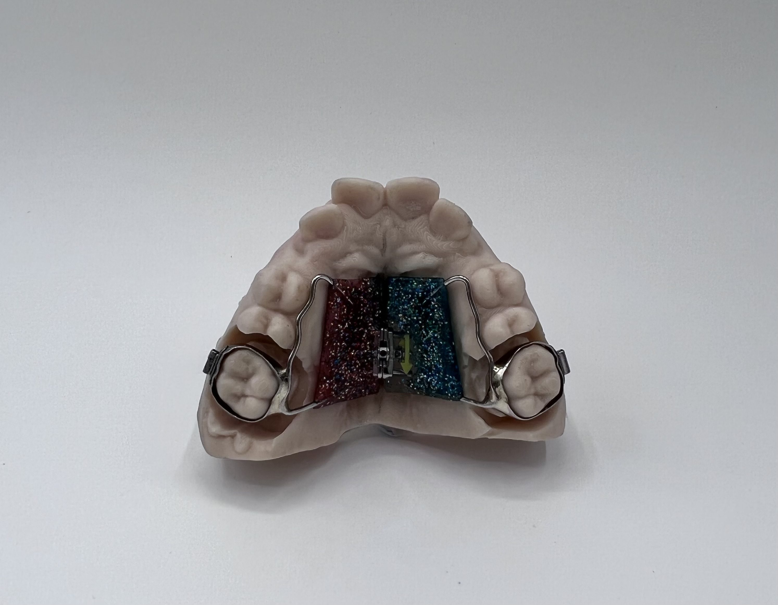 Services - Brisbane Braces